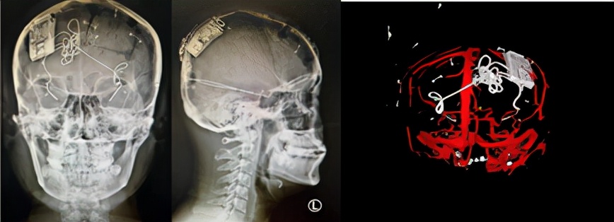 影像評估 影像評估