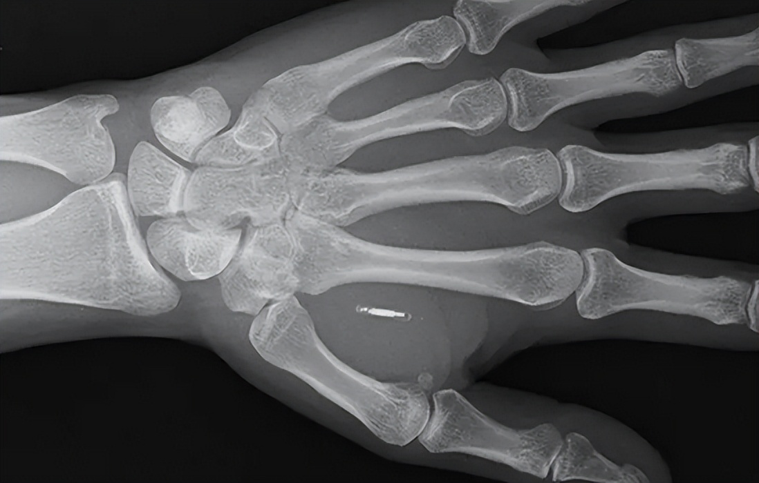 從現金到刷臉,如今RFID帶你體驗“伸手支付”- IOTE物聯網展