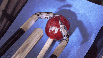 葡萄皮縫合手術 葡萄皮縫合手術