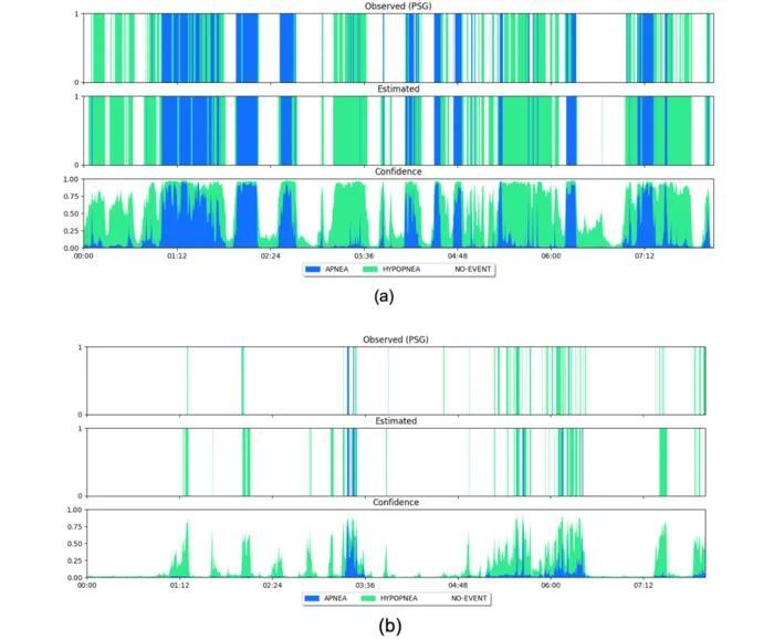 韓國開發出可在家測量睡眠呼吸暫停的AI技術 韓國開發出可在家測量睡眠呼吸暫停的AI技術